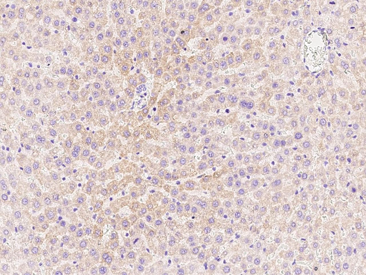 CPT2 Antibody (Preservative Free)