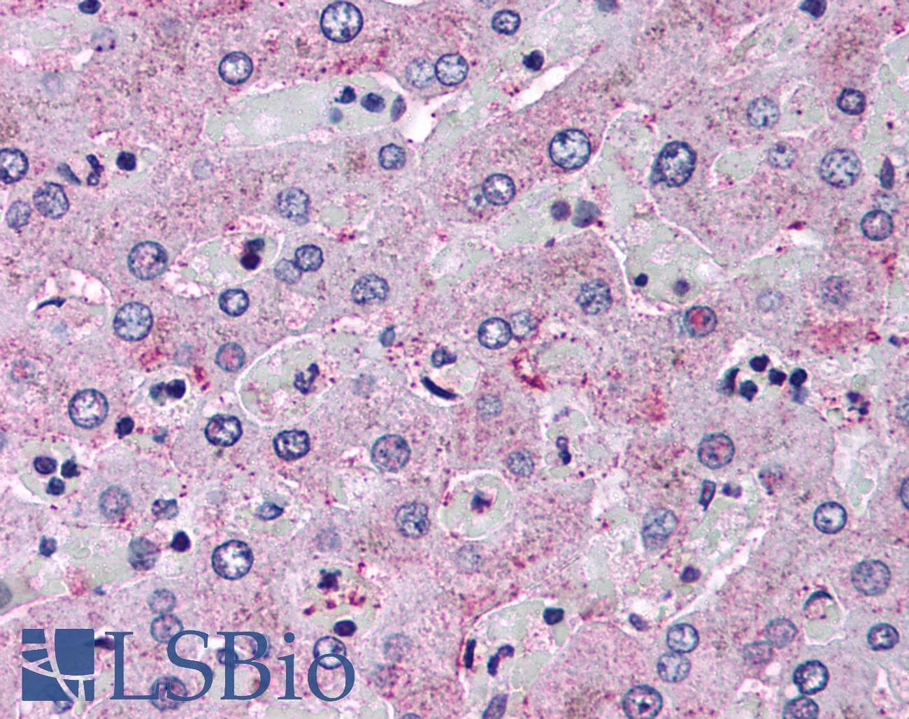 IHC-plus™ GCGR / Glucagon Receptor Antibody (N-Terminus)