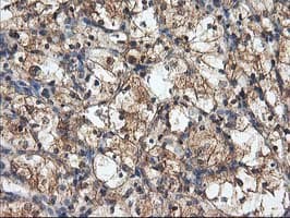 HARS2 Antibody (clone OTI3F1)