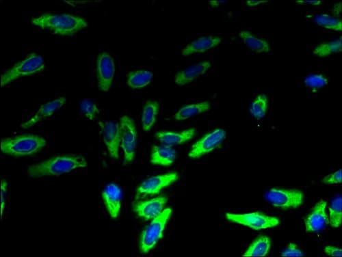 IHC-plus™ LYPLA2 Antibody