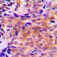 Polyclonal Rabbit anti-Human ACOT2 Antibody (Internal, IHC, IF, WB)