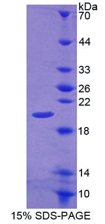 Rat CALY Protein (Recombinant His-T7, N-terminus)