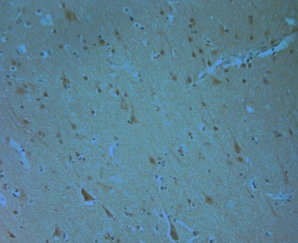 Polyclonal Rabbit anti-Human ERK1 + ERK2 Antibody (phospho-Thr202/Tyr204, IHC, WB)