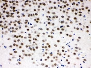 Polyclonal Rabbit anti-Mouse ZBTB7A / Pokemon Antibody (IHC, WB)