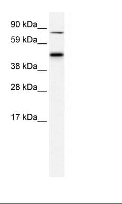 EPB42 Antibody (aa448-497)