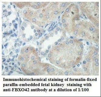 Polyclonal Rabbit anti-Human FBXO42 / JFK Antibody (aa563-717, IHC, WB)