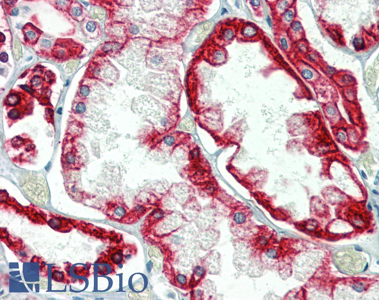 PathPlus™ Monoclonal Mouse anti-Human KRT18 / CK18 / Cytokeratin 18 Antibody (clone DC-10, IHC, WB)