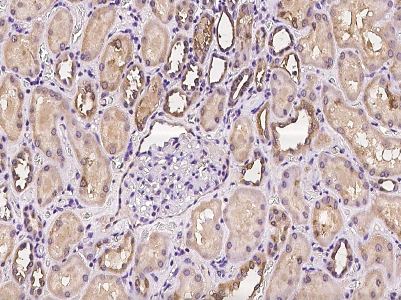 DCDC2 Antibody