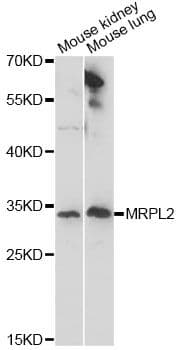 MRPL2 Antibody