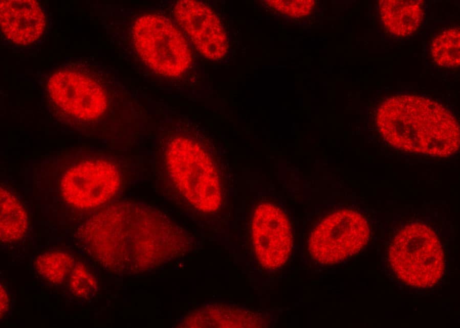 Polyclonal Rabbit anti-Human CHEK1 / CHK1 Antibody (phospho-Ser280, IHC, IF, WB)