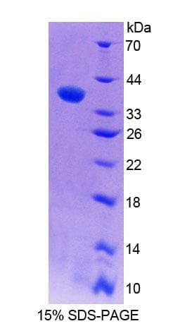 Rat RNASEH2A Protein (Recombinant His-T7, N-terminus)