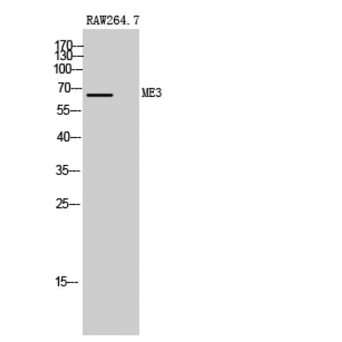 Polyclonal Rabbit anti-Human ME3 Antibody (520-600 aa, C-terminal, IHC, WB)