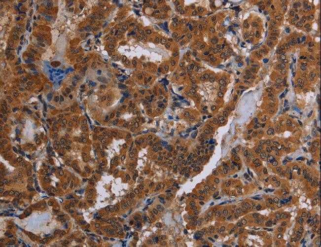 Polyclonal Rabbit anti-Human CYBB / NOX2 / gp91phox Antibody (IHC)