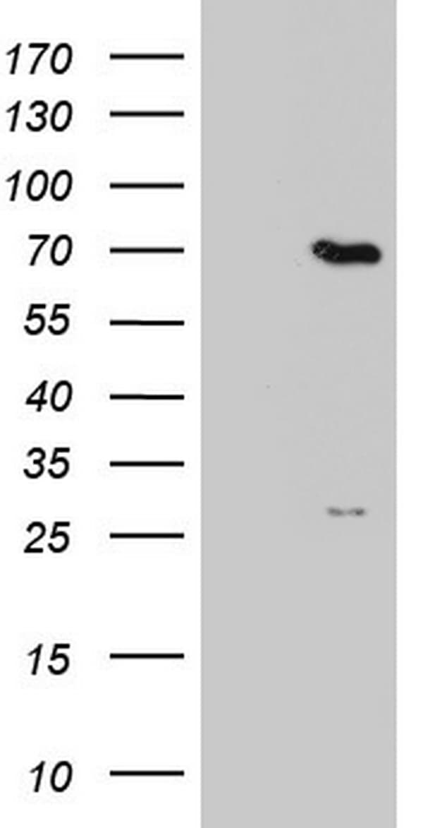 PPP2R5D Antibody (clone OTI2F2)