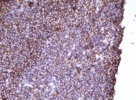 CD20 Antibody (clone OTI1H4)