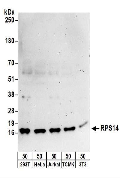 IHC-plus™ RPS14 / Ribosomal Protein S14 Antibody (aa101-151)
