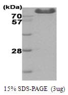 Human HK3 / Hexokinase 3 Protein (Recombinant His)