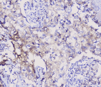 Polyclonal Rabbit anti-Human ENO2 / NSE Antibody (IHC, WB)