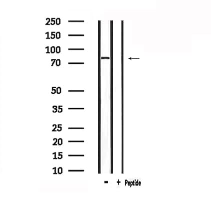 Polyclonal Rabbit anti-Human TICAM1 / TRIF Antibody (IHC, WB)