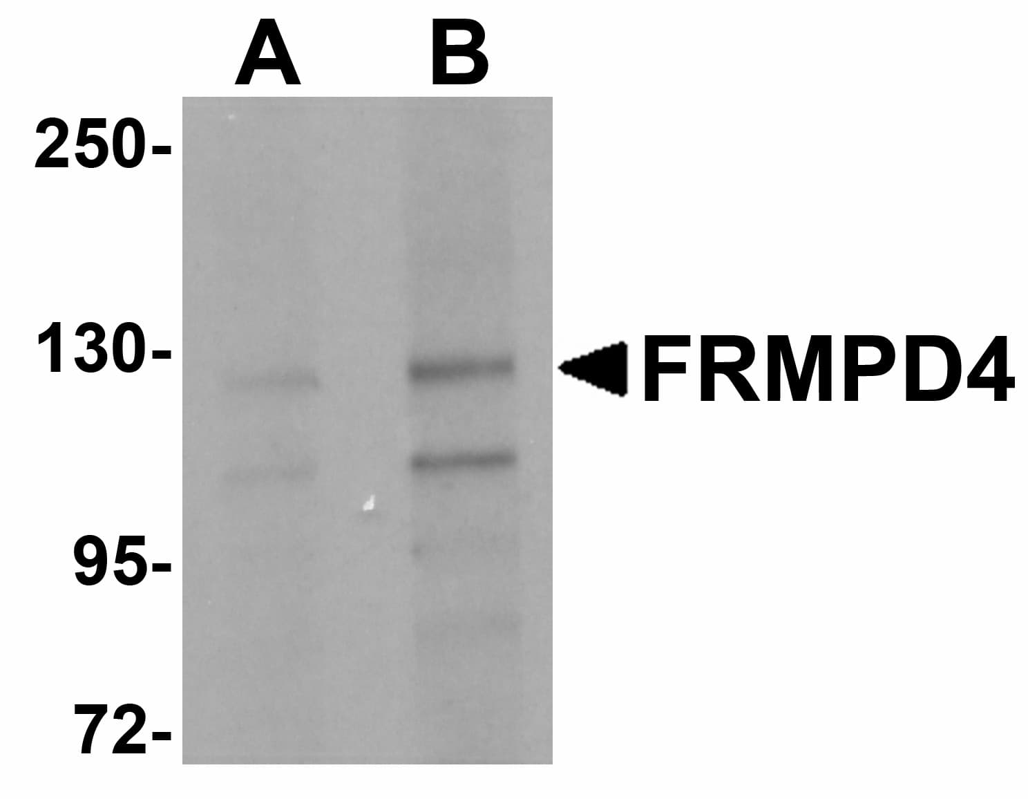 IHC-plus™ FRMPD4 Antibody