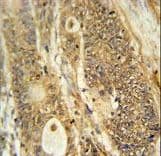 AVIL / Advillin Antibody (aa176-204)