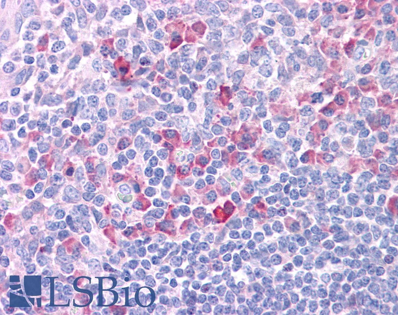 DLL1 Antibody (N-Terminus)