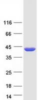 Human BCAT2 Protein (Recombinant Myc-DDK (Flag))