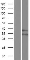 RHBDD1 Protein (Over-Expression Lysate Myc-DDK (Flag))