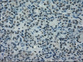Monoclonal Mouse anti-Human PRKY Antibody (clone OTI5E9, Carrier-free, IHC, IF, WB)