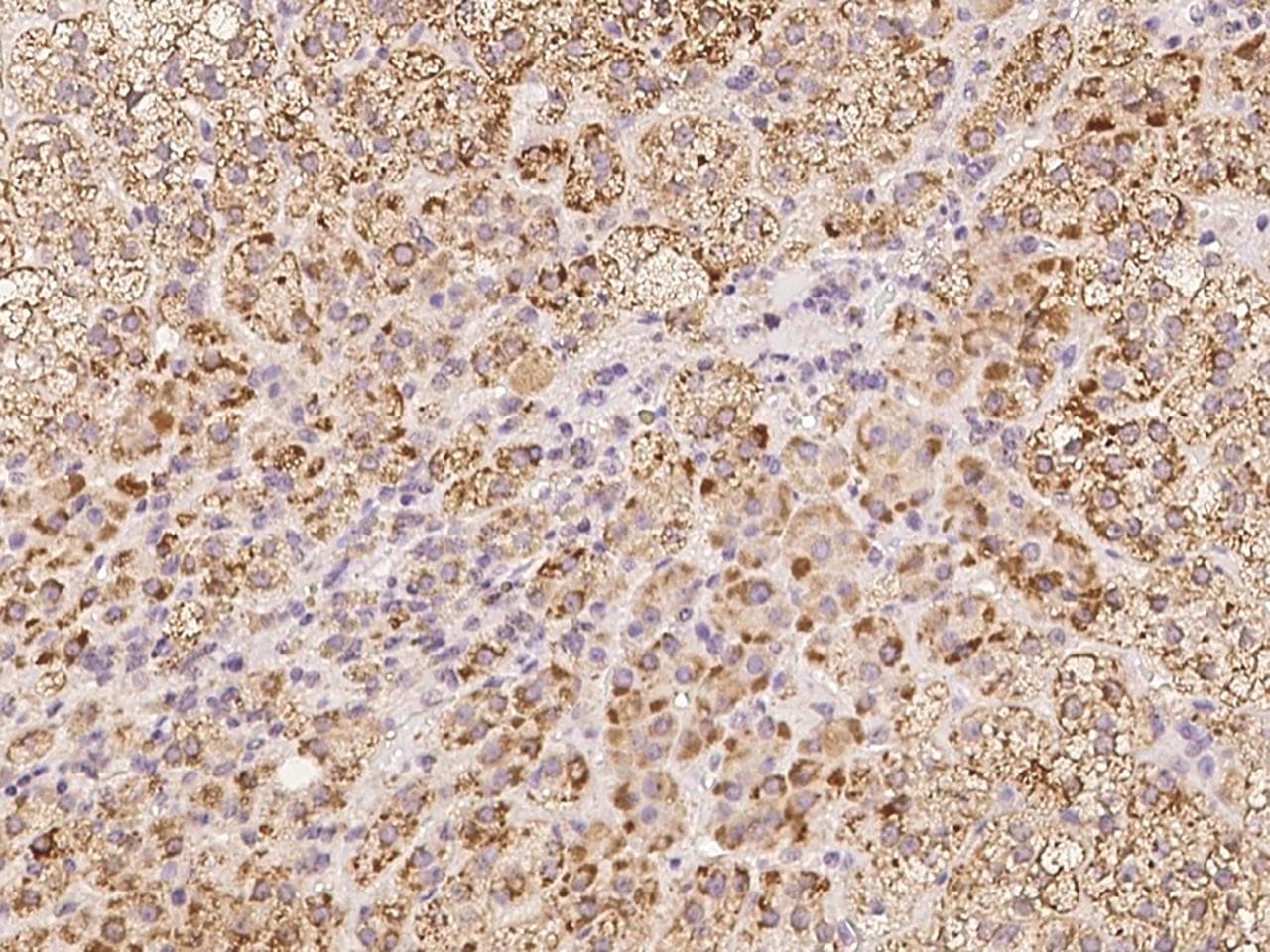 Polyclonal Rabbit anti-Human ACSF2 Antibody (IHC)