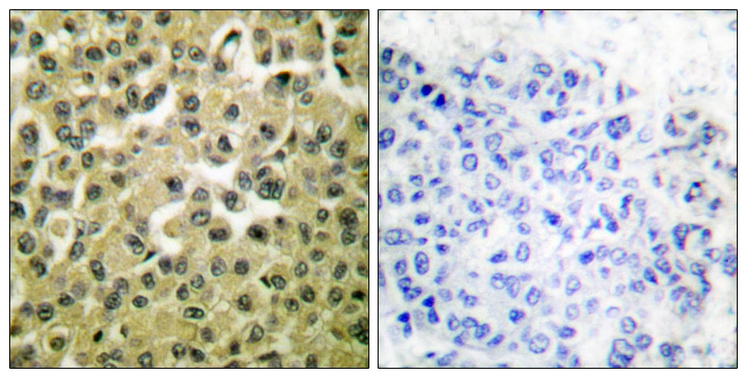 MCL1 / MCL 1 Antibody