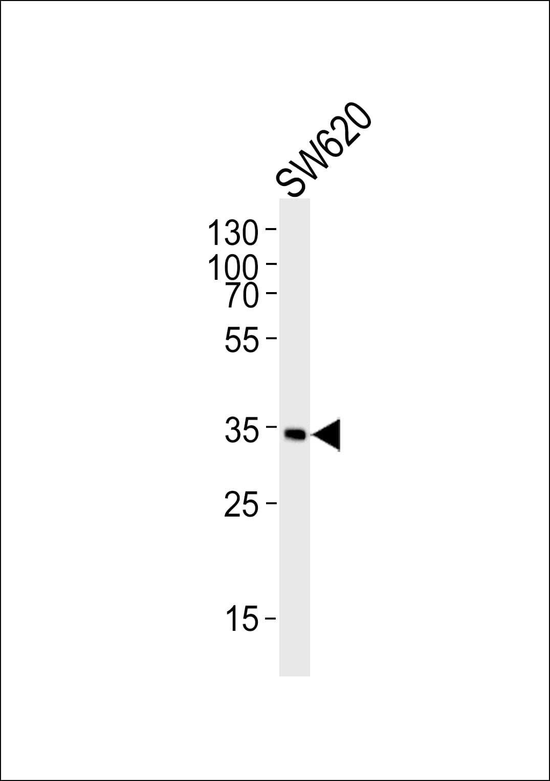 GC1qR / C1QBP Antibody (aa51-85)
