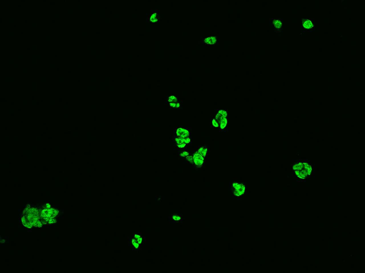 Polyclonal Rabbit anti-Human HNRNPC / HNRNP C Antibody (IHC, IF, WB)