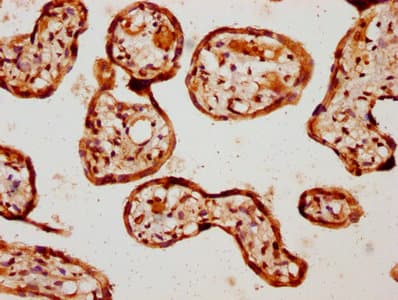 ALK3 / BMPR1A Antibody (aa177-532)