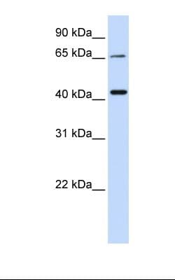 QPCTL Antibody (aa218-267, HRP)