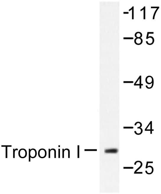 Polyclonal Rabbit anti-Human TNNI3 / Cardiac Troponin I Antibody (Lys39, IHC, WB)