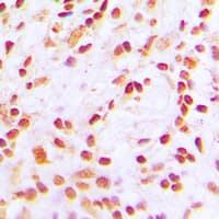Polyclonal Rabbit anti-Human CREBBP / CREB Binding Protein Antibody (Acetyl-Lys1535, IHC, IF, WB)