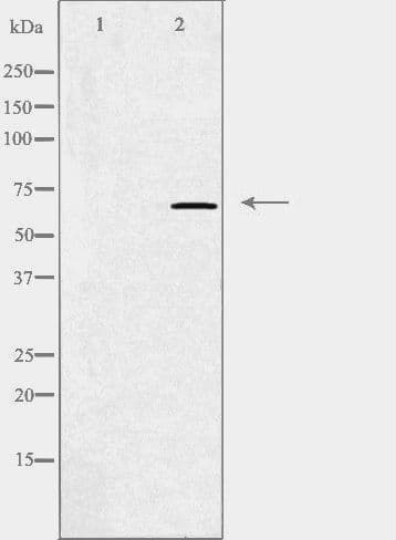 GRK5 Antibody