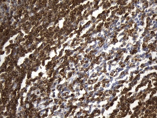 CD74 / CLIP Antibody (clone UMAB231, Carrier-free)