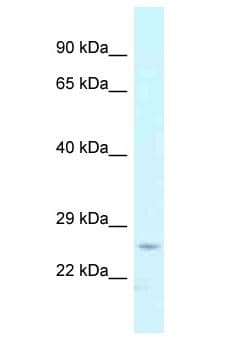 CMPK / CMPK1 Antibody (aa61-110)