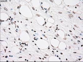 PLK1 / PLK-1 Antibody (clone OTI5C1)