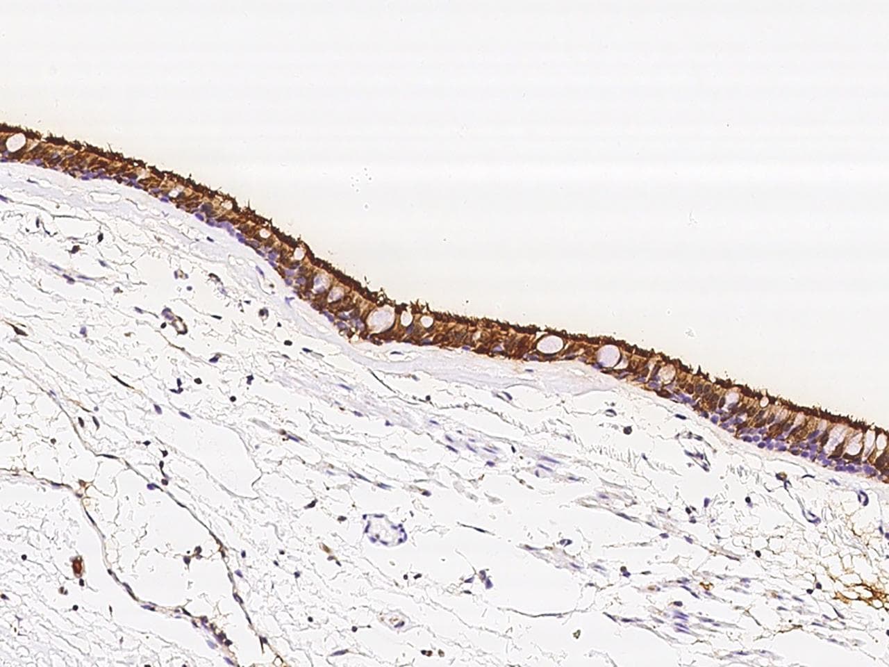 Polyclonal Rabbit anti-Human TPPP2 Antibody (IHC, IF)
