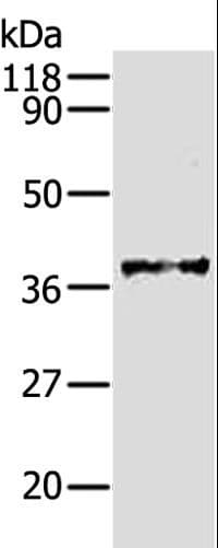 Polyclonal Rabbit anti-Human AKR1B1 / Aldose Reductase Antibody (IHC, WB)