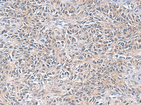 UBE2N / UBC13 Antibody