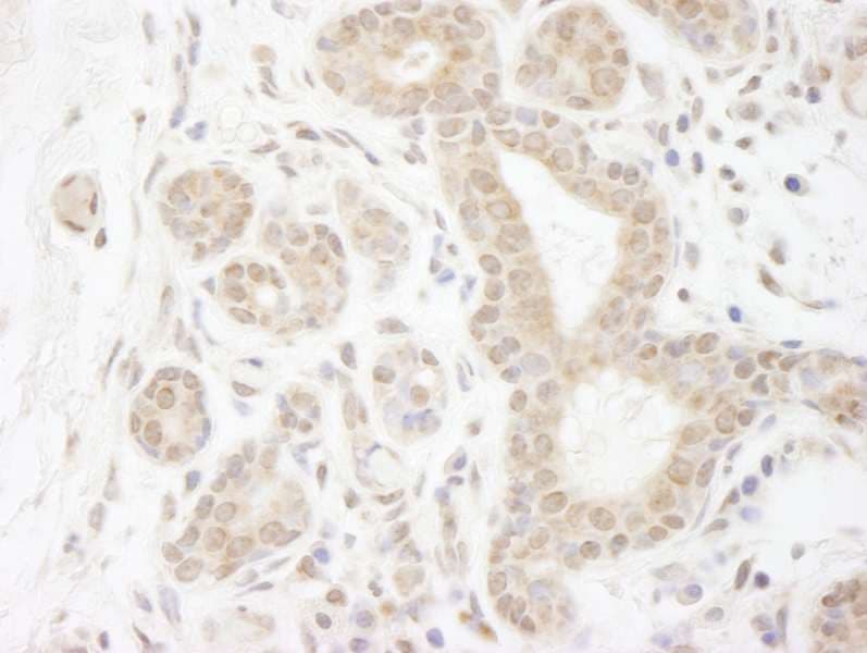 DDX20 / GEMIN3 Antibody (aa600-650)