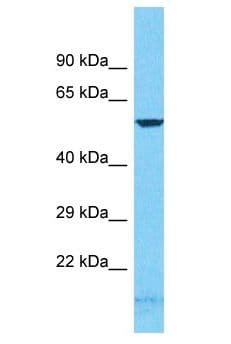 Polyclonal Rabbit anti-Human GCM2 Antibody (aa133-182, WB)