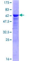 Human PKDCC / SGK493 Protein (Recombinant GST)