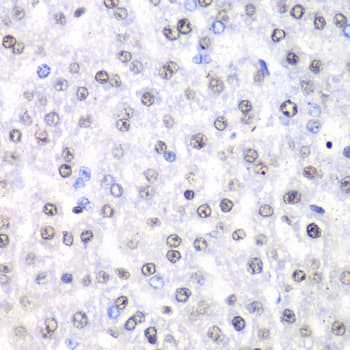 Polyclonal Rabbit anti-Human NONO / P54NRB Antibody (IHC, IF, WB)
