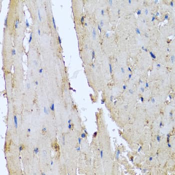 IHC-plus™ DEFA1 / Defensin Alpha 1 Antibody