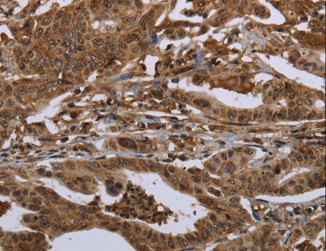 Polyclonal Rabbit anti-Human 15-PGDH / HPGD Antibody (IHC)